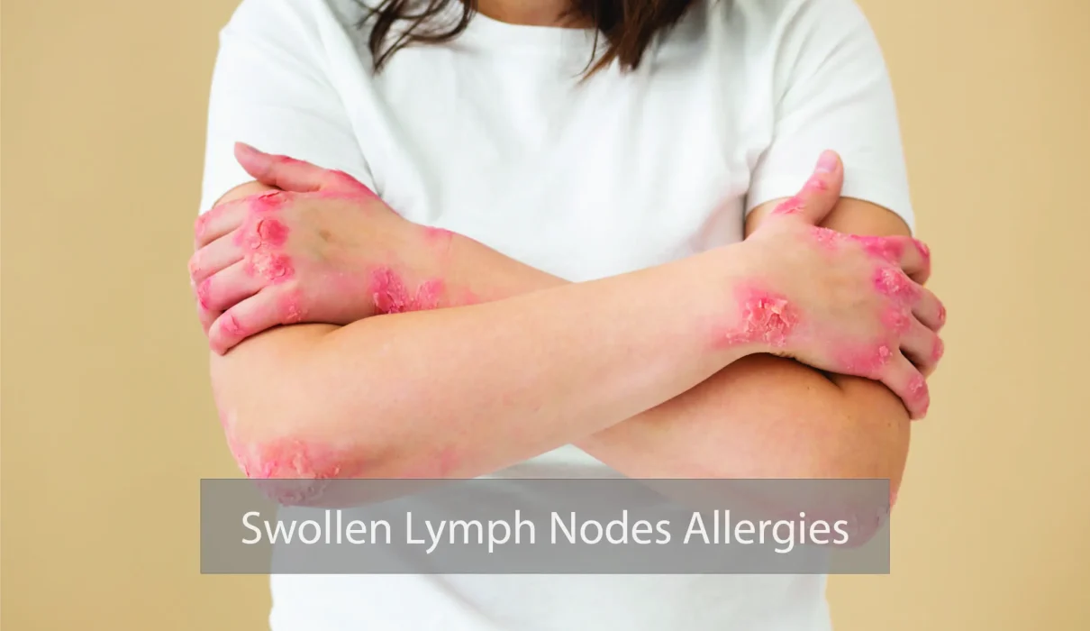 An informative image addressing swollen lymph nodes due to allergies, exploring causes, symptoms, and treatment options.