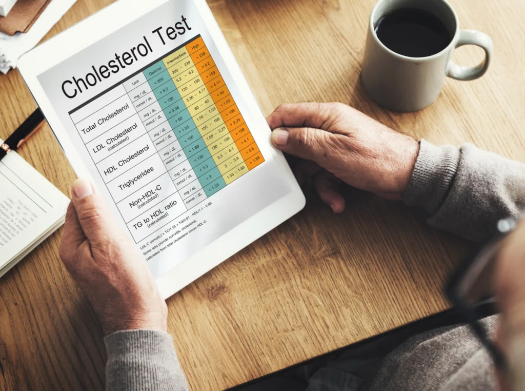 High Cholestrol Test