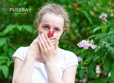 How to Control Skin Allergy Naturally